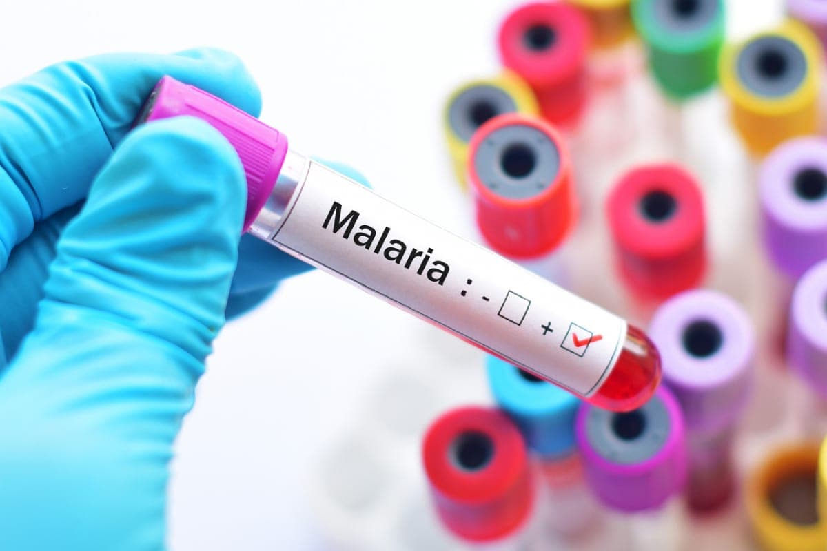 Malaria Detection System